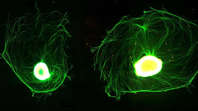 Two dorsal root ganglion neurons labelled to show the rounded cell bodies with numerous long, thin projections.