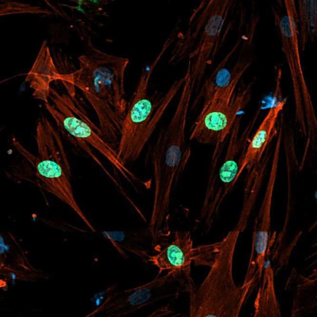 Multiplying fibroblasts