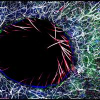 Immunofluorescent image of immune cells surrounding a skin wound