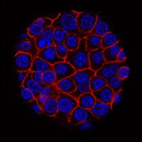 Pancreatic Cancer Cells