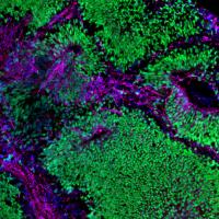 Brain organoid depicting neural stem cells (green) and neurons (magenta).