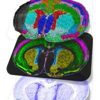 Spatial multiomics maps.