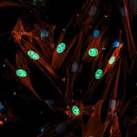 Illustration of distressed brain neurons.